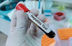 هشدار شیوع بالای هپاتیت A در کودکان و نوجوانان ایرانی