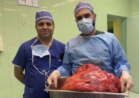 خارج کردن توده ۲۳ کیلویی از شکم زن تبریزی