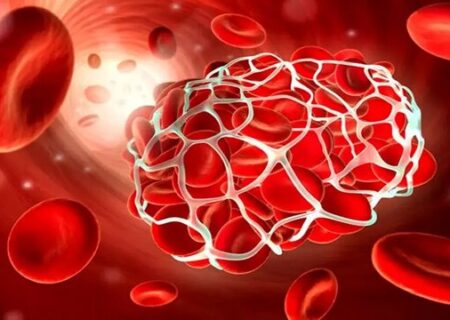 بیماران هموفیلی منتظر باشند/ کمبودهای دارویی، سراسری است