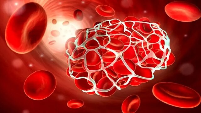 بیماران هموفیلی منتظر باشند/ کمبودهای دارویی، سراسری است